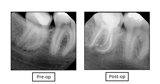 Crescent dental